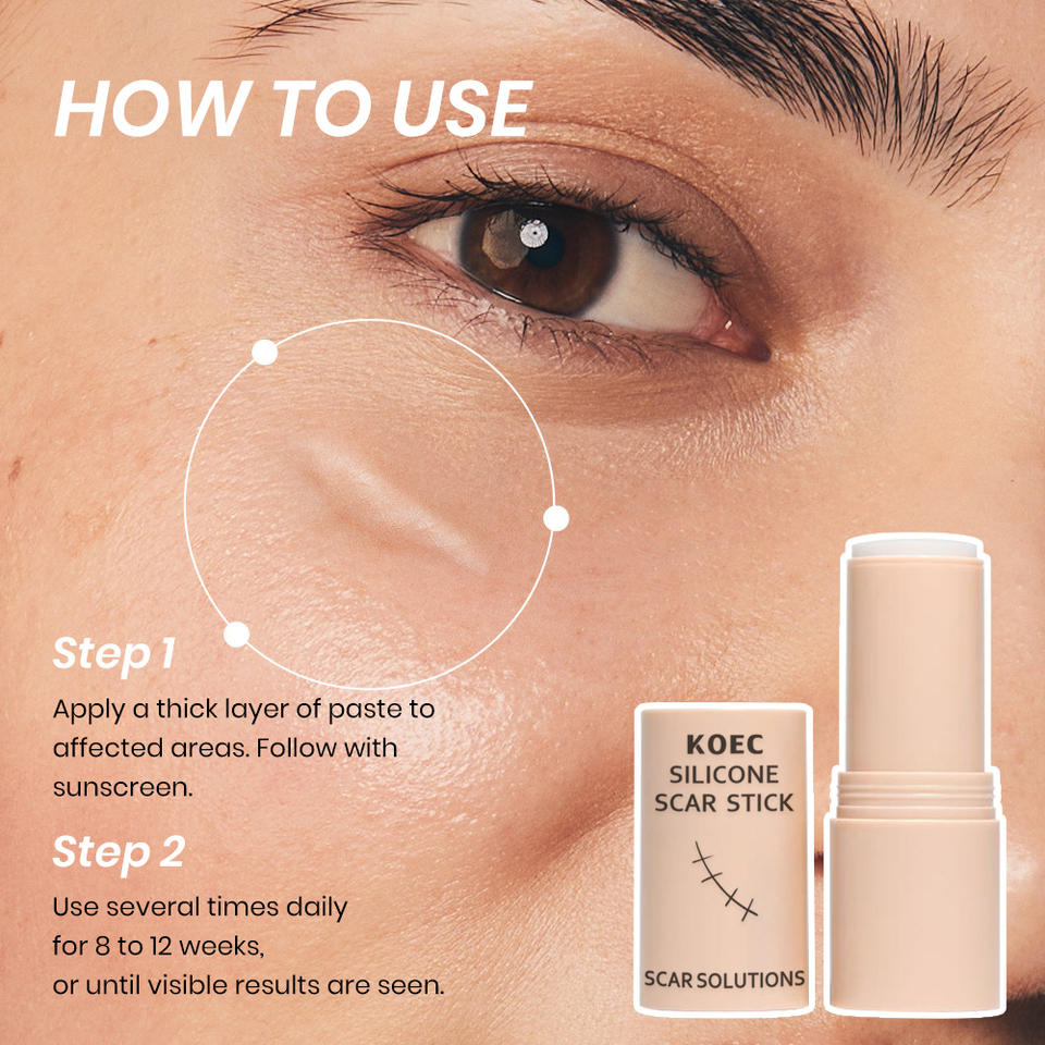Koec Lightens Scars Nourishes Stick Burn Acne Scar Skin Repair Cares Improves Scar Appearance Moisturizing Rejuvenating Balm - Buy  Product on Alibaba.com