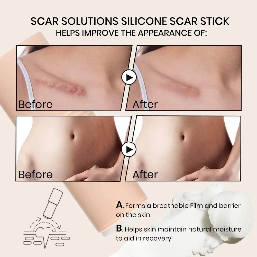 Koec Lightens Scars Nourishes Stick Burn Acne Scar Skin Repair Cares Improves Scar Appearance Moisturizing Rejuvenating Balm